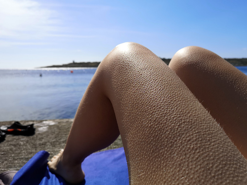 一個女人腿上起雞皮疙瘩的特寫，布吉巴，馬耳他圖片素材