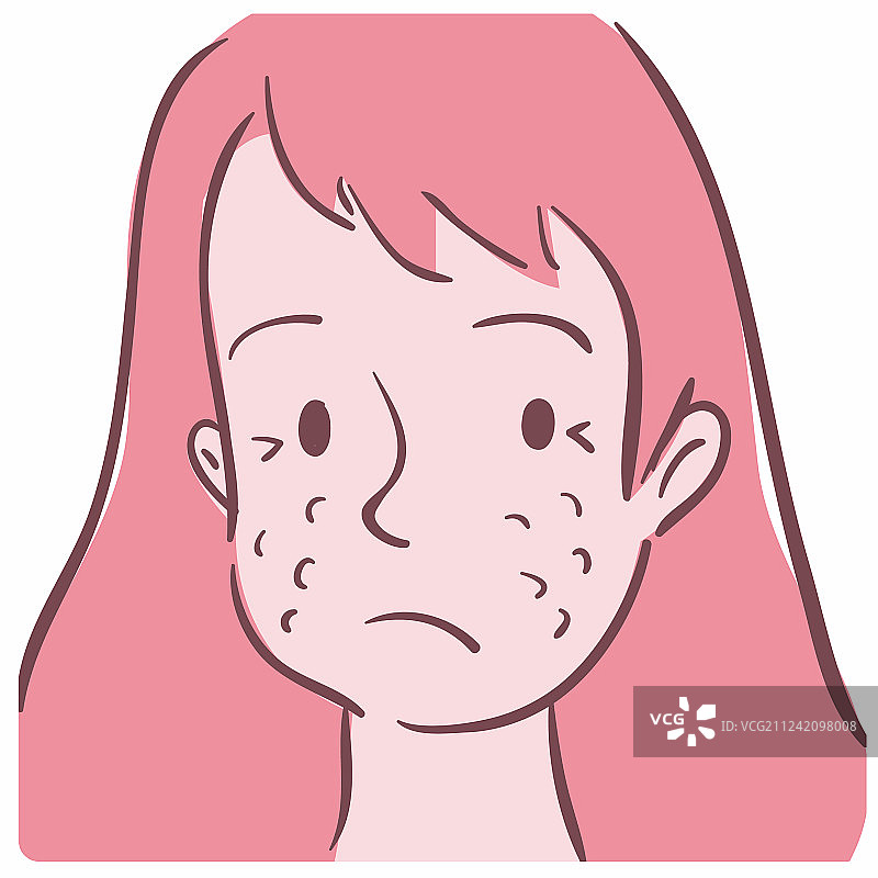 一个脸上长着粉刺的女孩图片素材