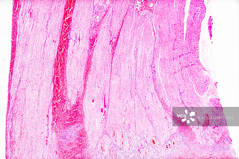 生物病理显微镜切片标本骨骼肌萎缩白底微距摄影图片素材