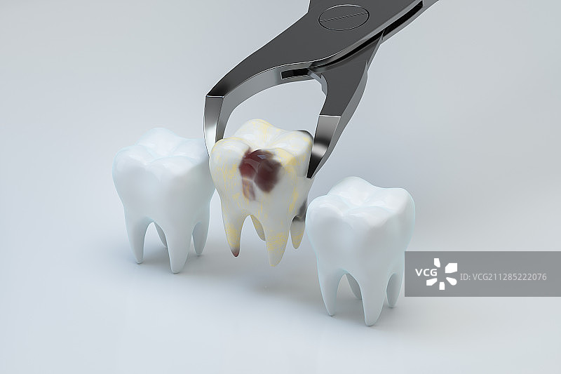 用钳子拔出坏牙 3D渲染图片素材