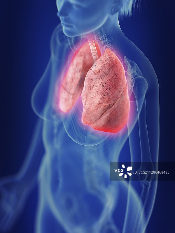 一个发炎的肺的插图图片素材