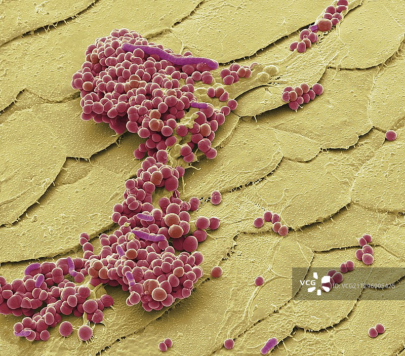 毛囊炎的细菌,扫描电镜图片素材