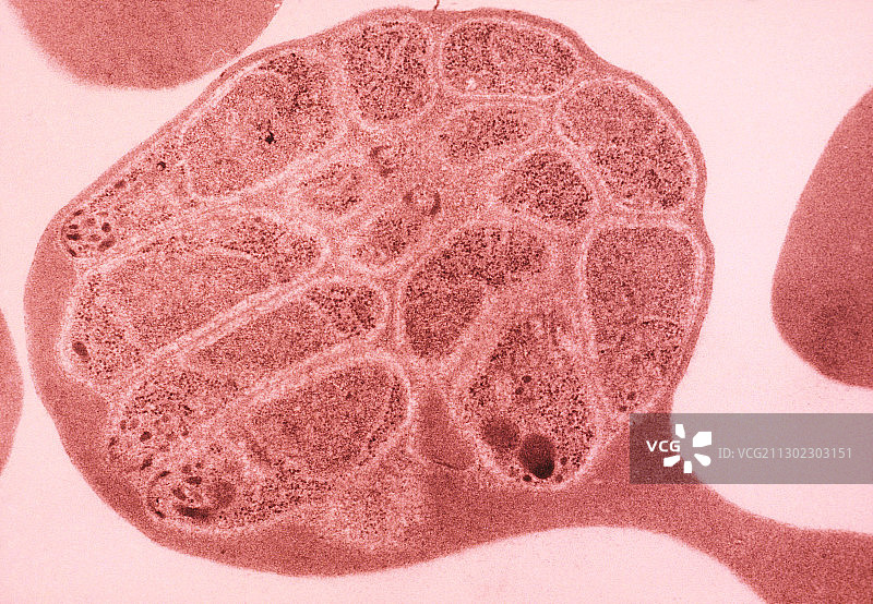 疟疾感染红细胞的透射电镜染色。图片素材