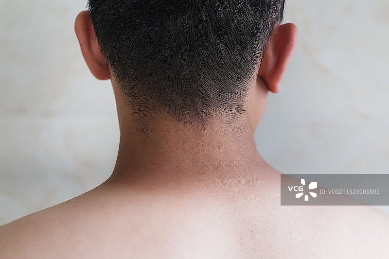 亚洲男性背部晒黑颜色对比，防晒主题。图片素材