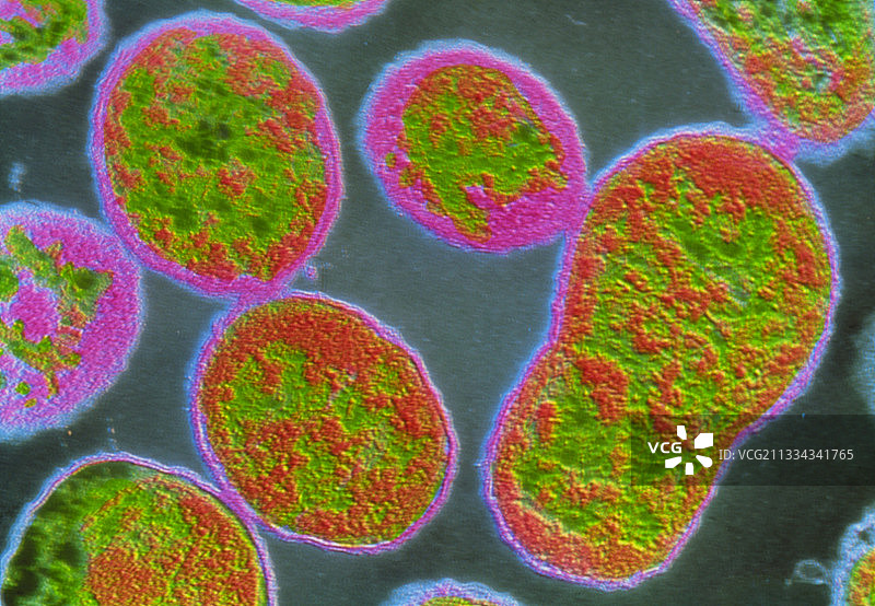 f/流产布鲁氏菌彩色透射电镜图片素材