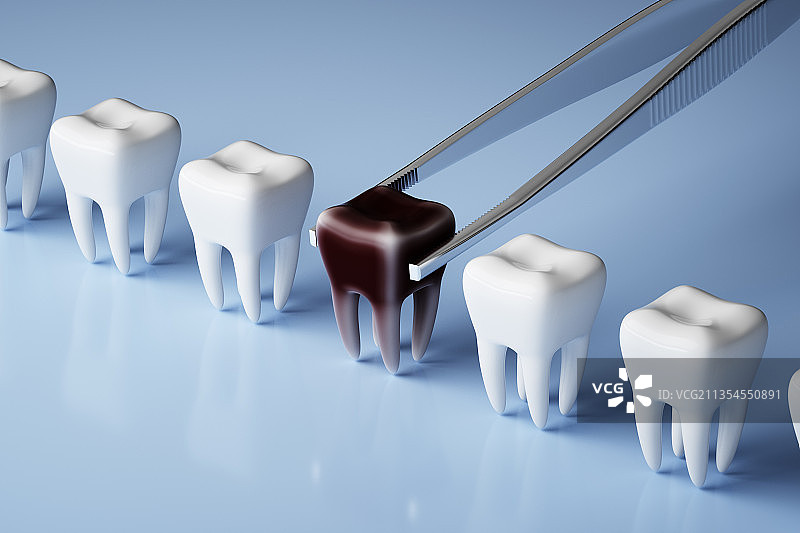 3D蛀牙拔除医学图片素材