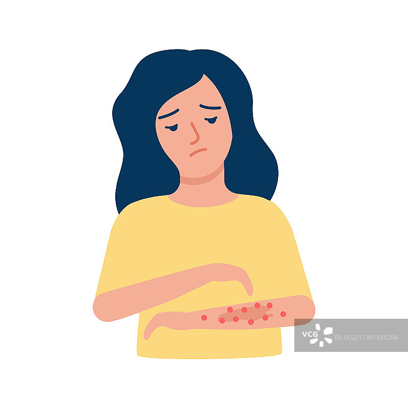 女人抓挠手臂皮疹过敏痤疮皮肤上图片素材