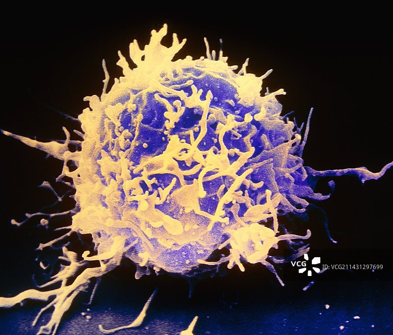 t淋巴细胞白血细胞的彩色扫描电镜图片素材