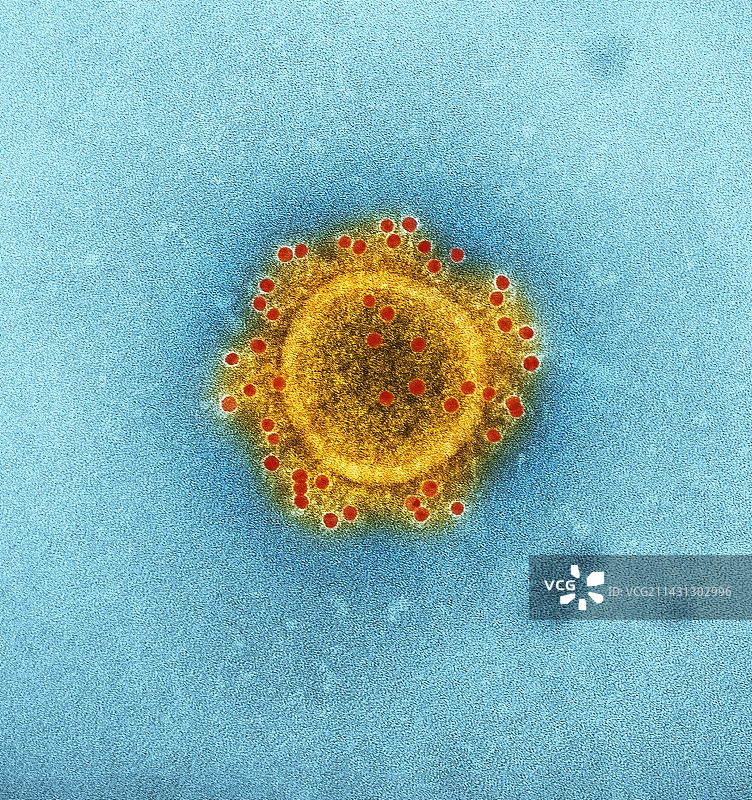MERS冠状病毒颗粒，透射电镜图片素材