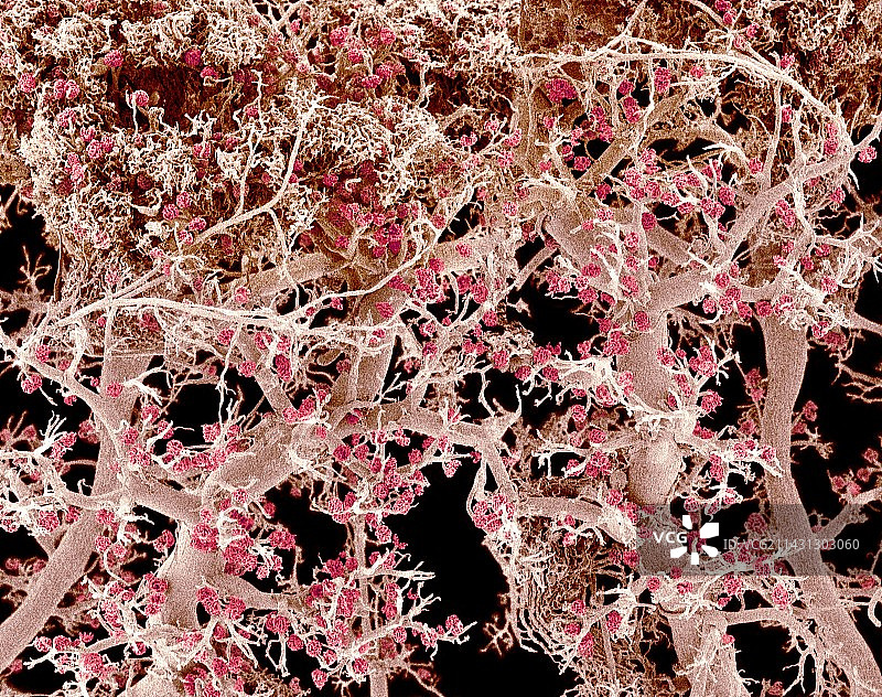 肾血管，扫描电镜图片素材