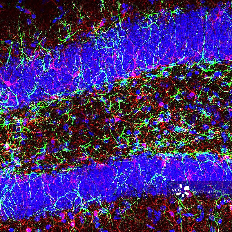 脑细胞，荧光显微照片图片素材