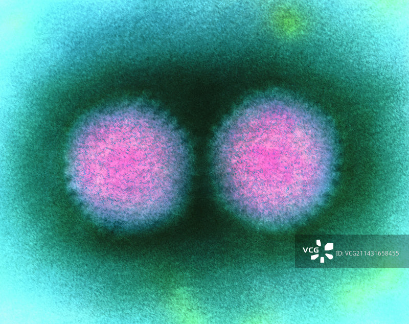 两种腺病毒的彩色透射电镜图片素材
