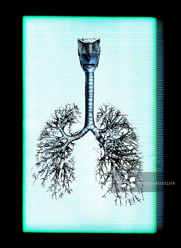人类的肺图片素材