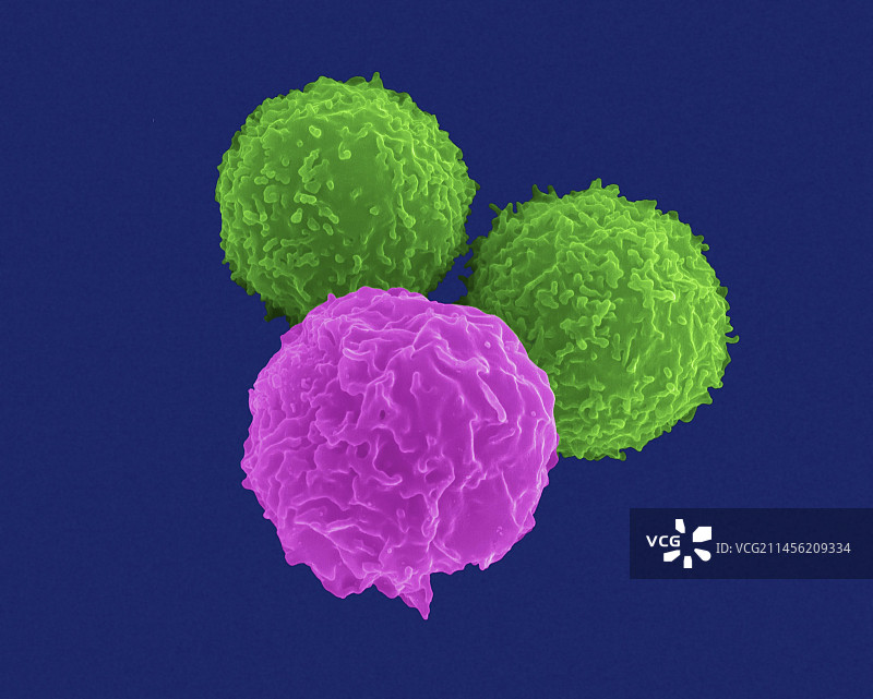 T淋巴细胞和中性粒细胞，扫描电镜图片素材