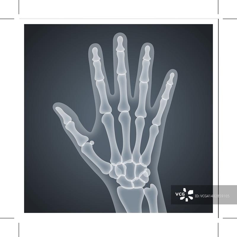 人类的手x射线图片素材