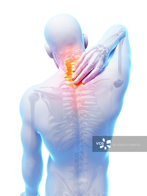 人类颈部疼痛，艺术品图片素材