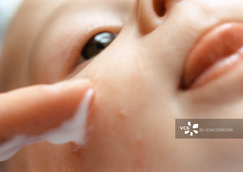 婴儿脸上的痘痘涂乳液，特写镜头图片素材