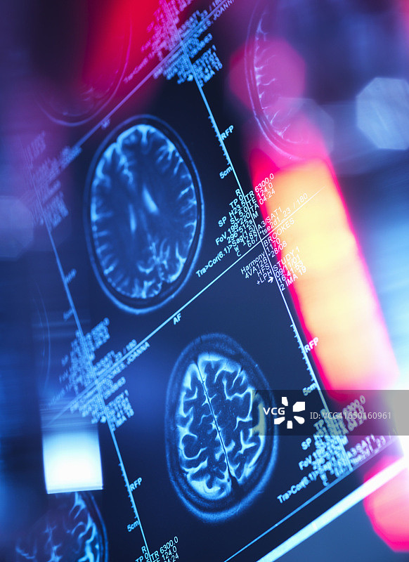 神经病学诊所的人脑扫描图片素材