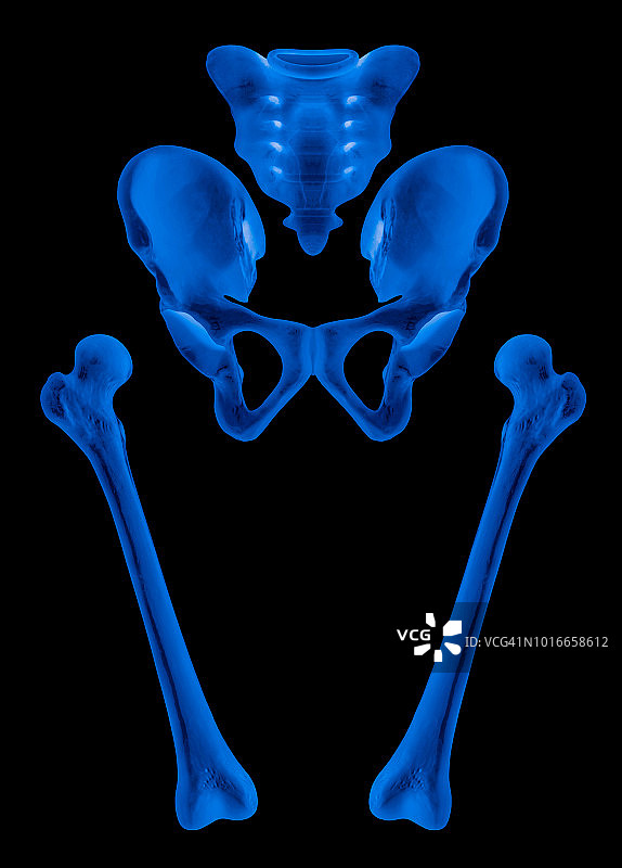 人体髋部和下肢骨骼分离-医疗保健- X射线蓝色胶片-人体解剖和医学概念-黑色背景分离。图片素材