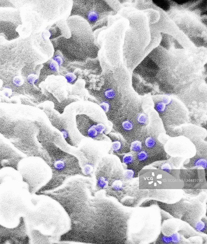 HIV病毒粒子SEM图片素材