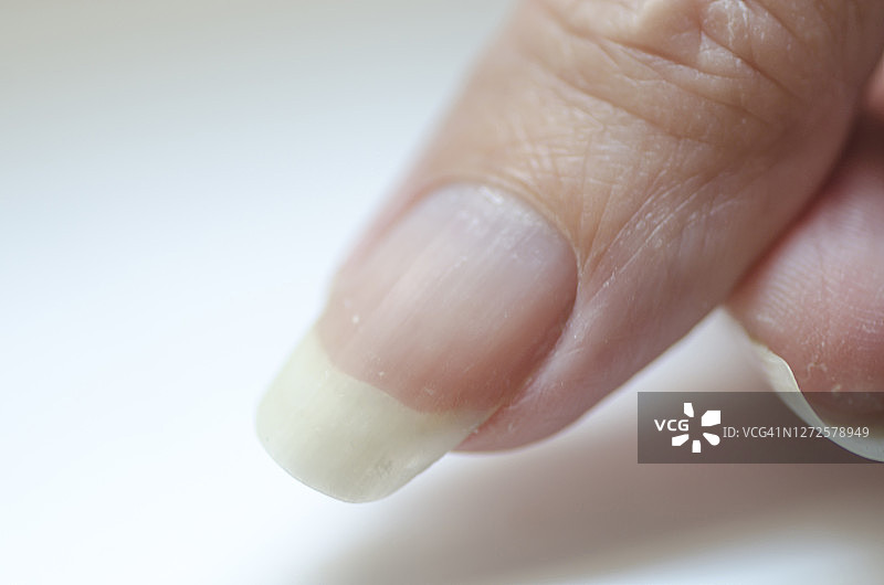 特写的脆性指甲。使用指甲油后对指甲的损害。指甲剥落。指甲的损伤。破碎的钉子。图片素材
