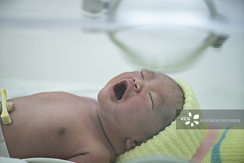 亚洲婴儿在保育箱中首次啼哭图片素材