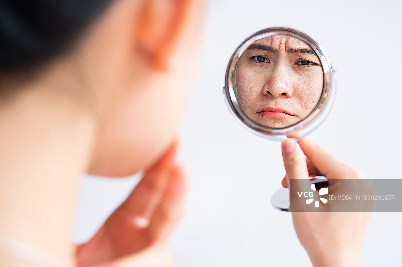 亚洲妇女担心她的脸，当她看到痤疮的问题发生在她的脸由迷你镜。图片素材