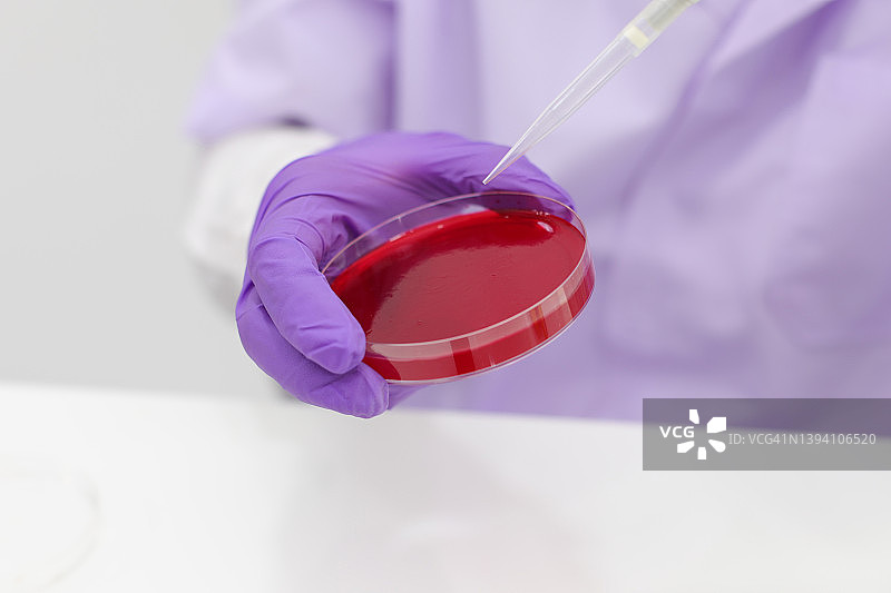 科学家们在培养皿中用琼脂做生物实验的手的特写。在实验室工作的科学家图片素材