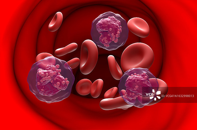 急性淋巴细胞白血病(ALL)血流中的癌细胞-三维剖面图图片素材