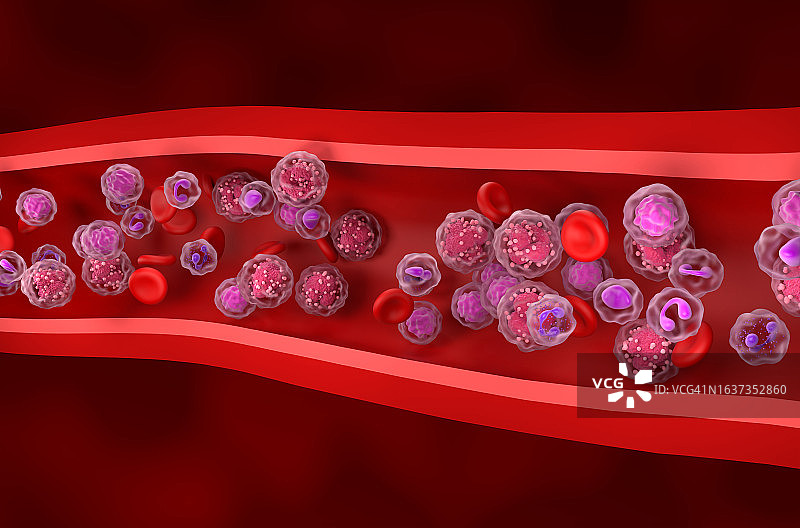 急性淋巴细胞白血病(ALL)血流中的癌细胞-等距视图三维插图图片素材