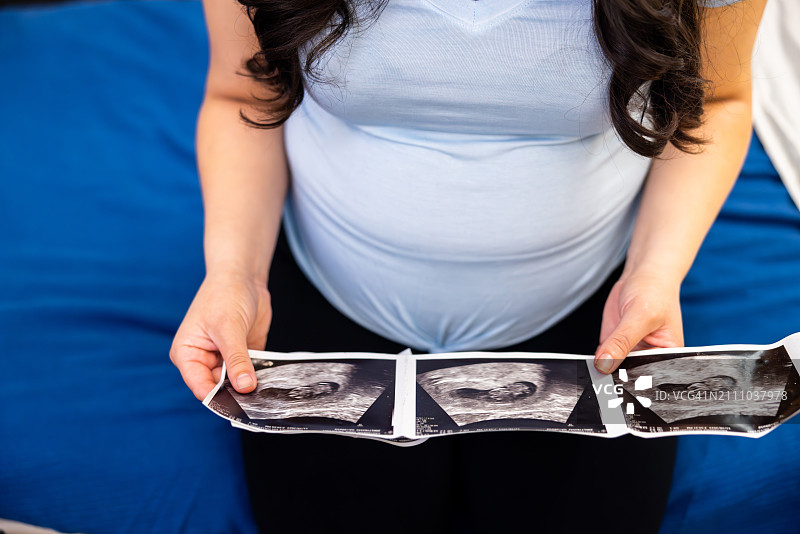 一名孕妇在医学检查室里看着她的超声波照片图片素材