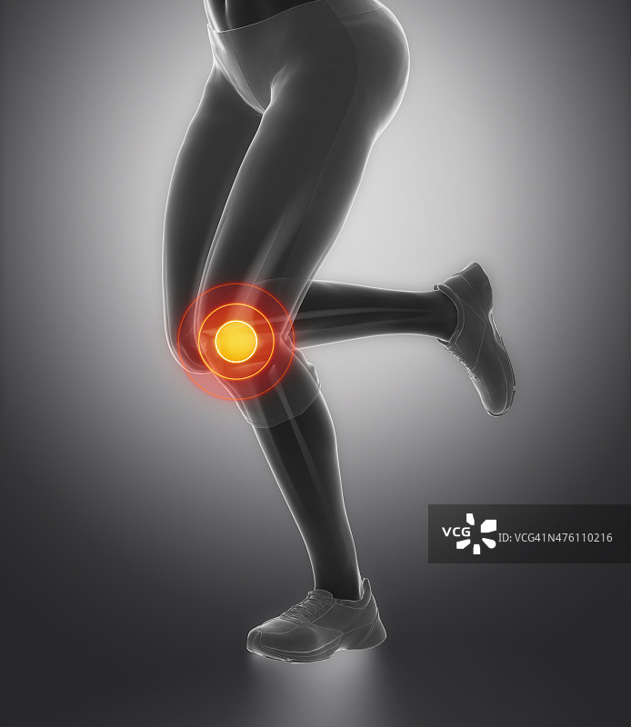 重点研究运动损伤的膝关节和半月板图片素材