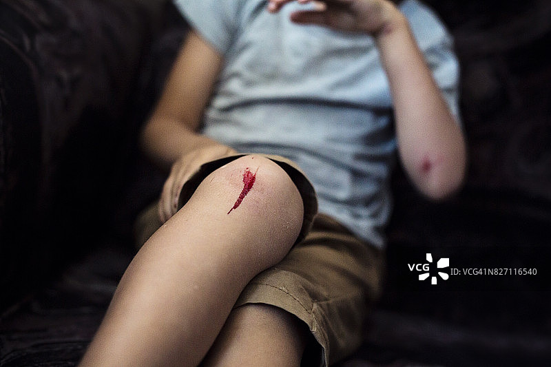 膝盖擦伤的男孩图片素材