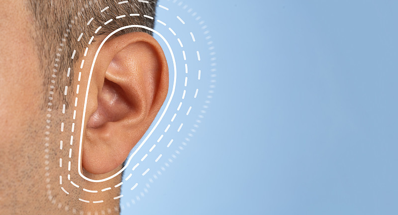 近距离的照片，一个人与棕色皮肤的耳朵。听力测试和耳外科手术的概念摄影图片下载