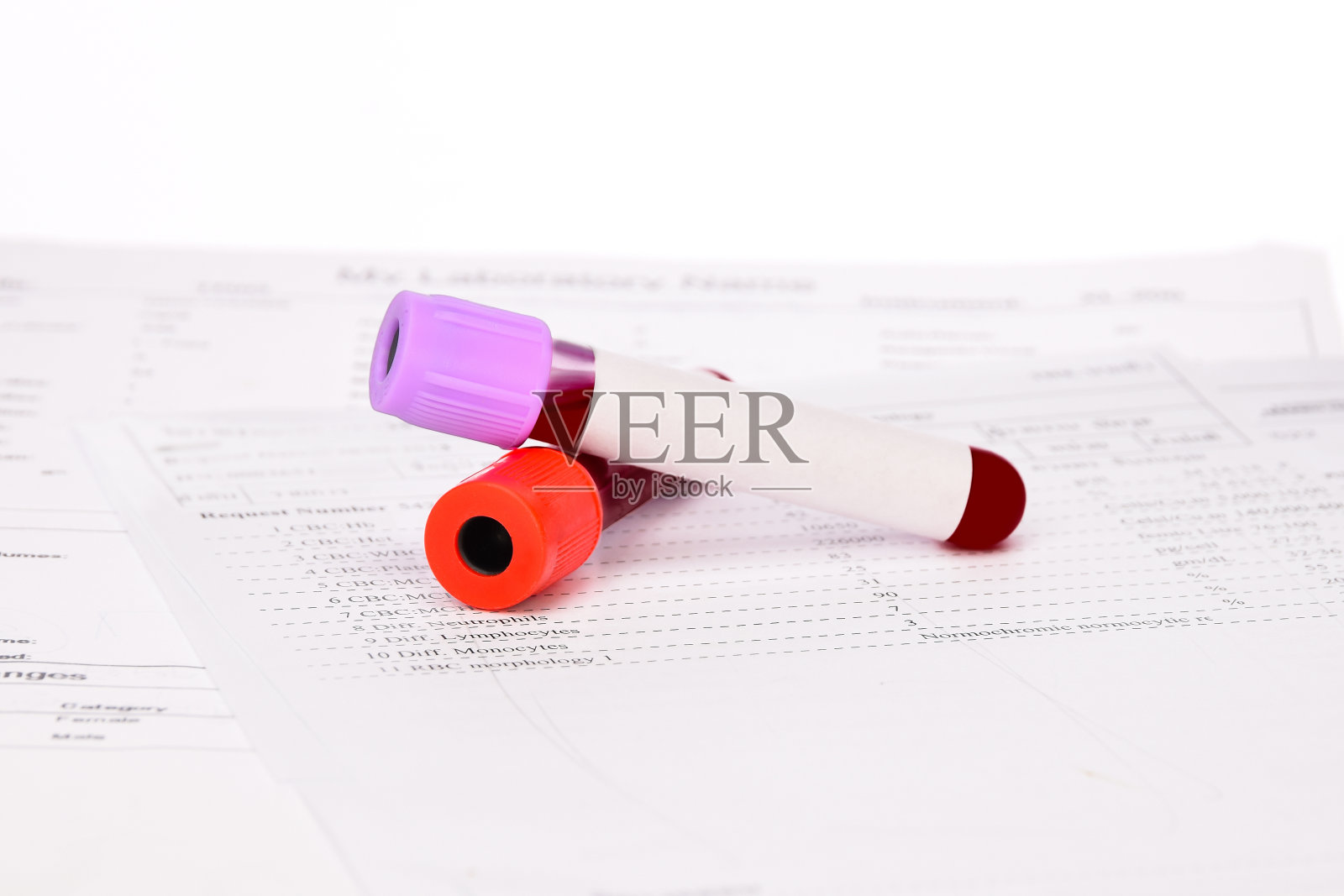 血液试管对血液检测形成背景。照片摄影图片