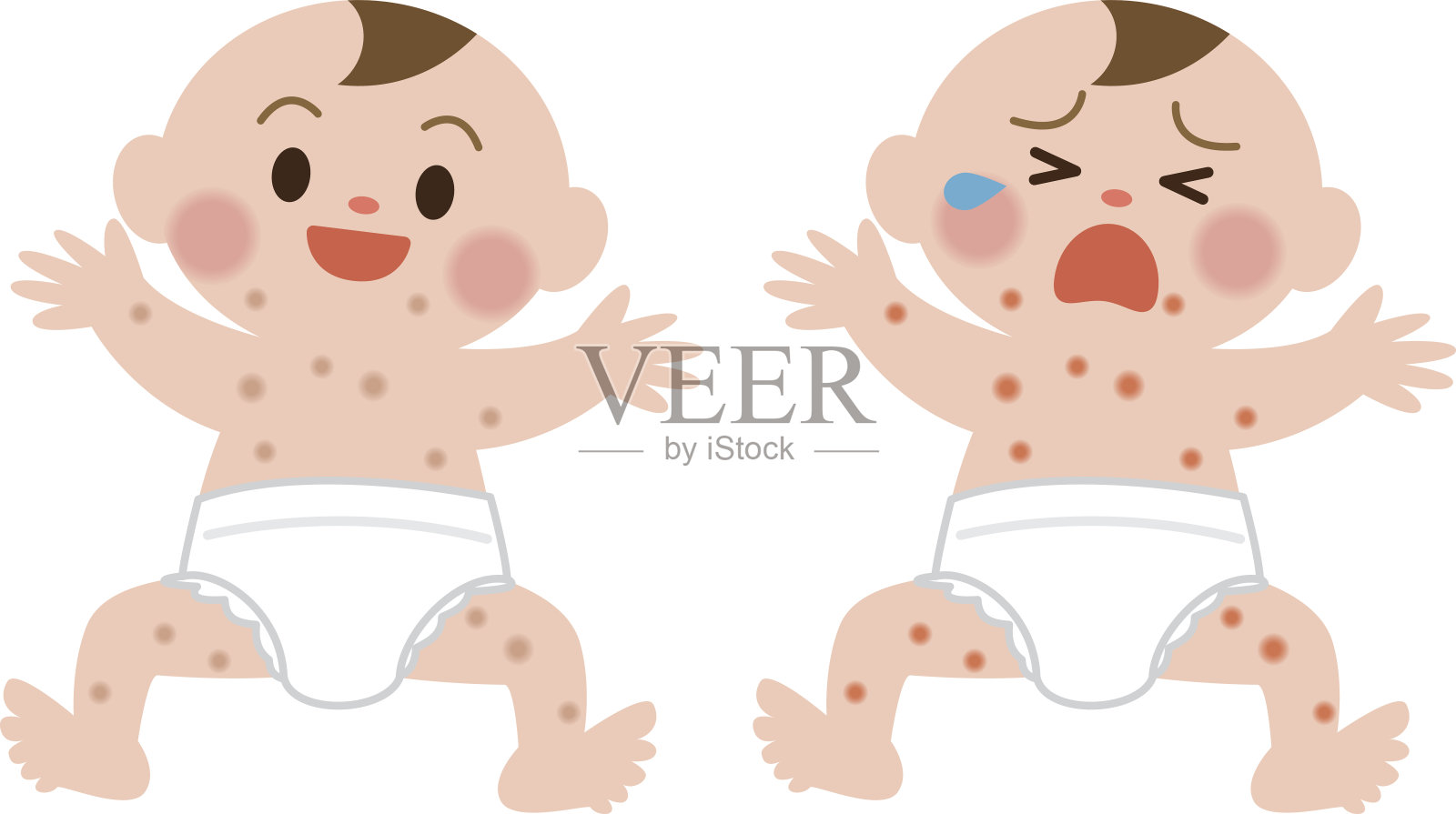 婴儿在皮疹中哭泣插画图片素材