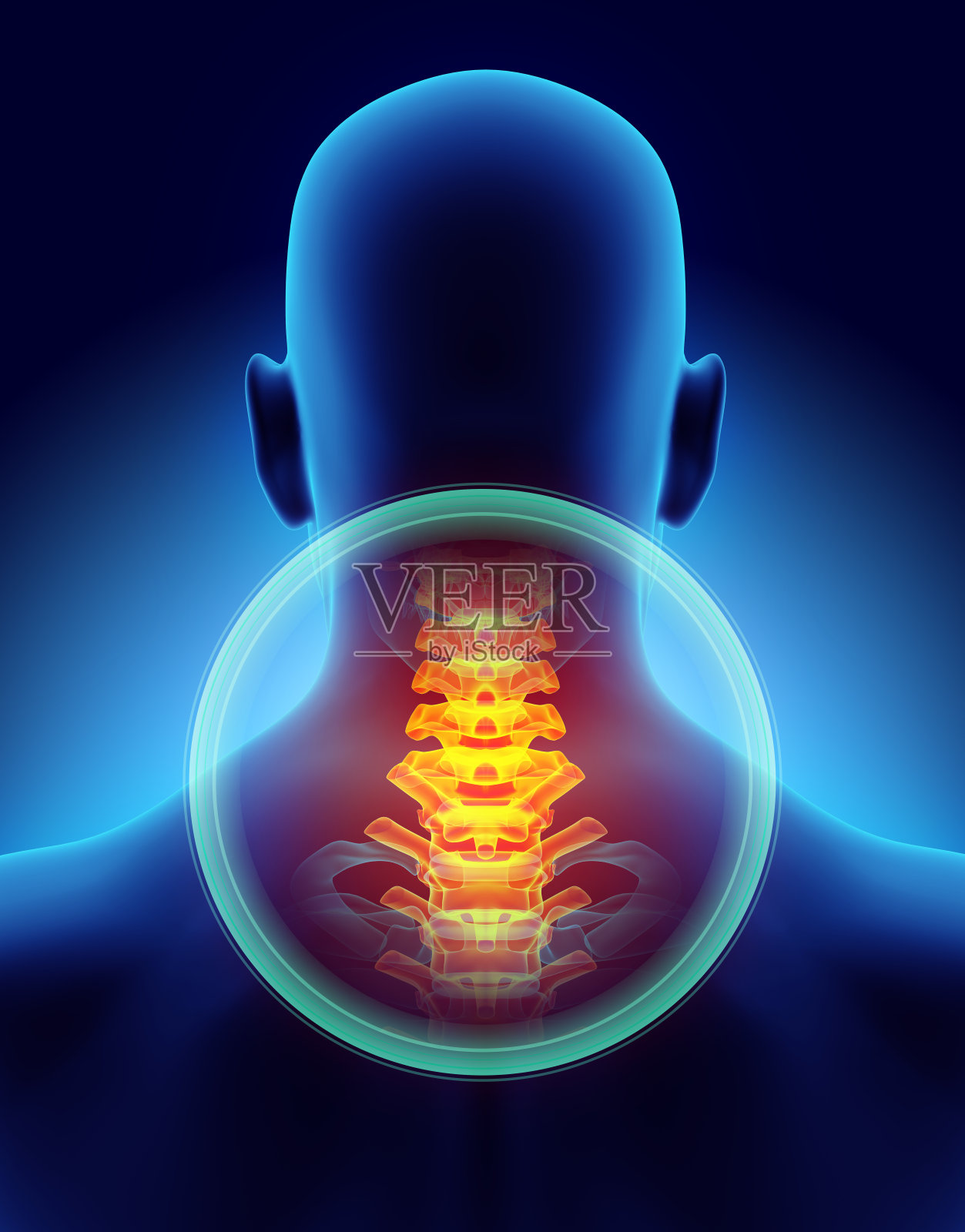 颈部疼痛-颈椎骨骼x光，3D插图。照片摄影图片
