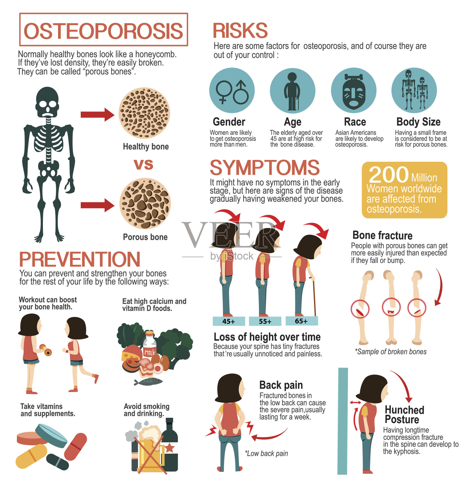 骨质疏松症的信息图表插画图片素材