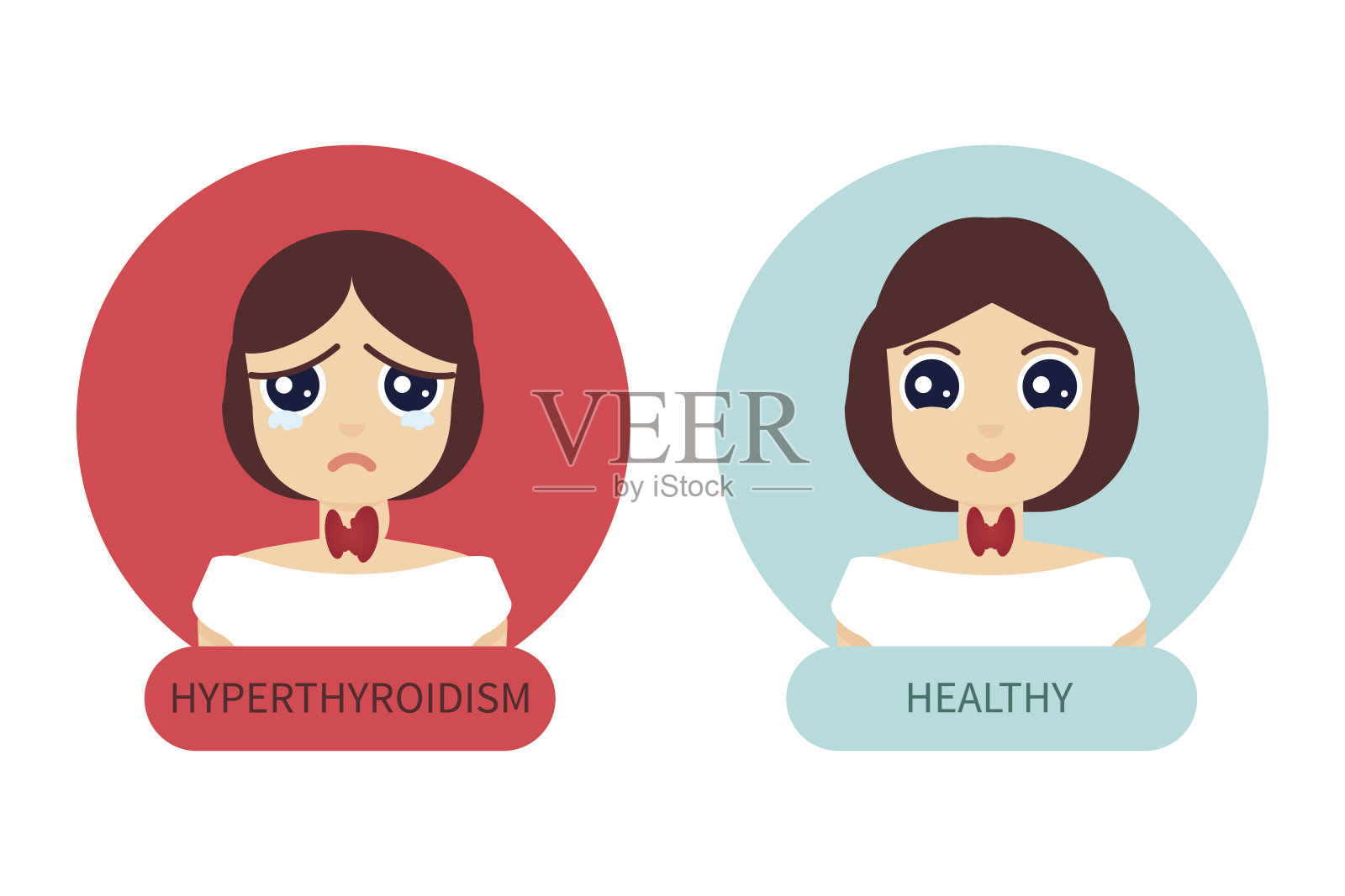 甲状腺正常和甲状腺机能亢进的妇女插画图片素材