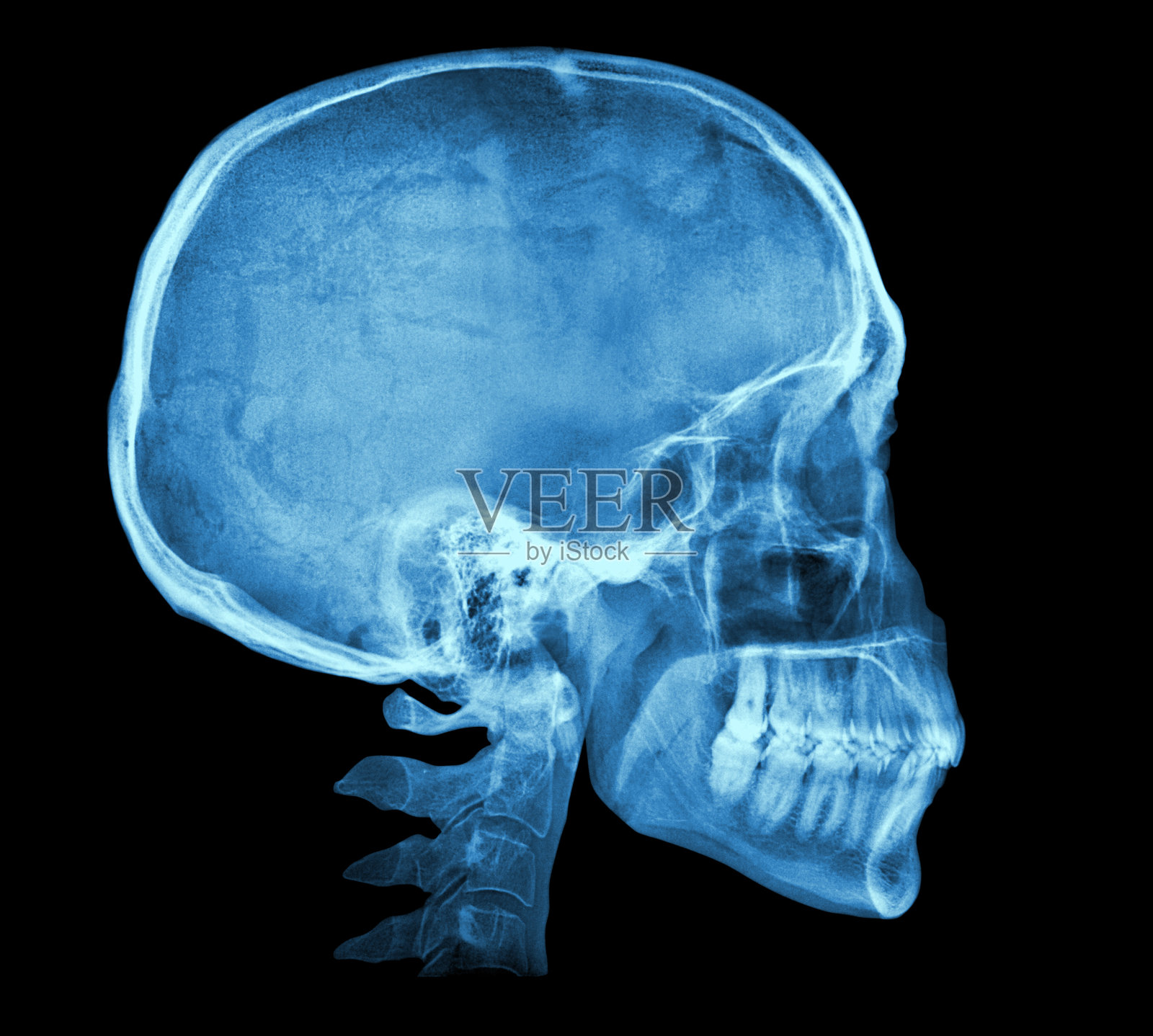 人类颅骨x射线图像照片摄影图片