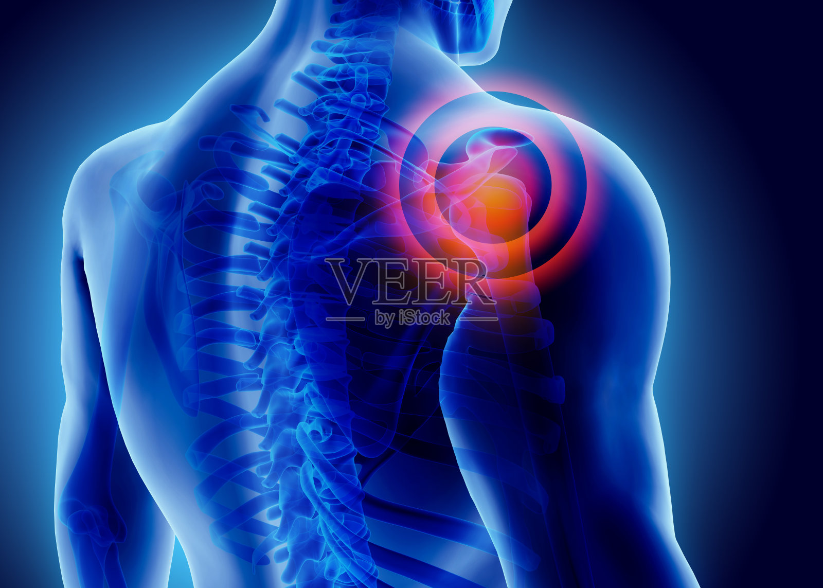 肩部疼痛的3D插图。照片摄影图片