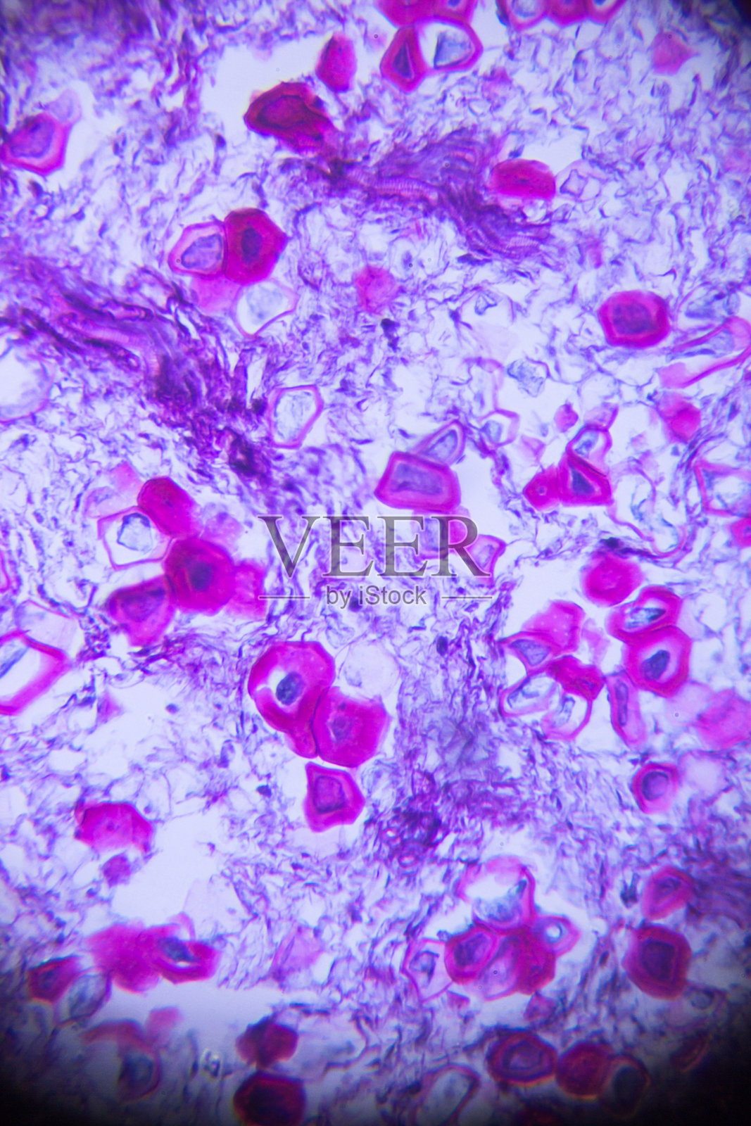 显微镜下的石梨细胞照片摄影图片