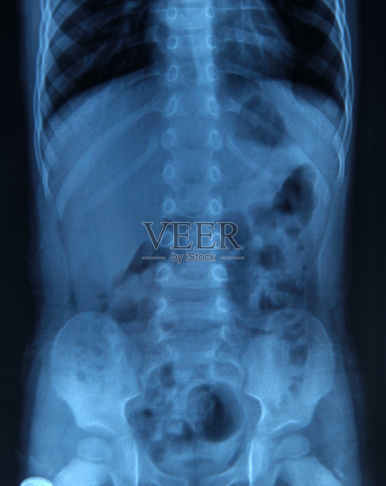 脊椎x光照片摄影图片