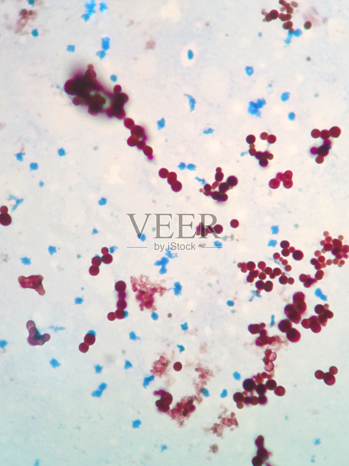 分枝杆菌是导致鱼类或宠物感染结核的细菌照片摄影图片