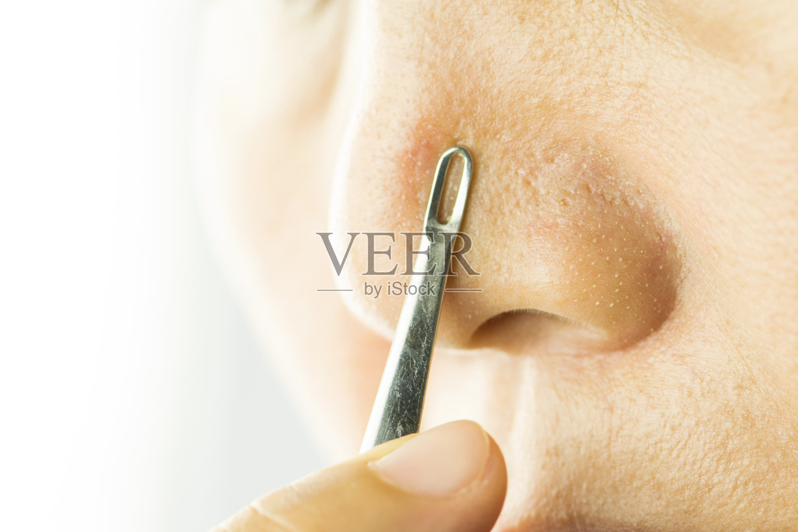 粉刺摘除器用于鼻子上的粉刺、小疙瘩。美丽与健康的概念。照片摄影图片