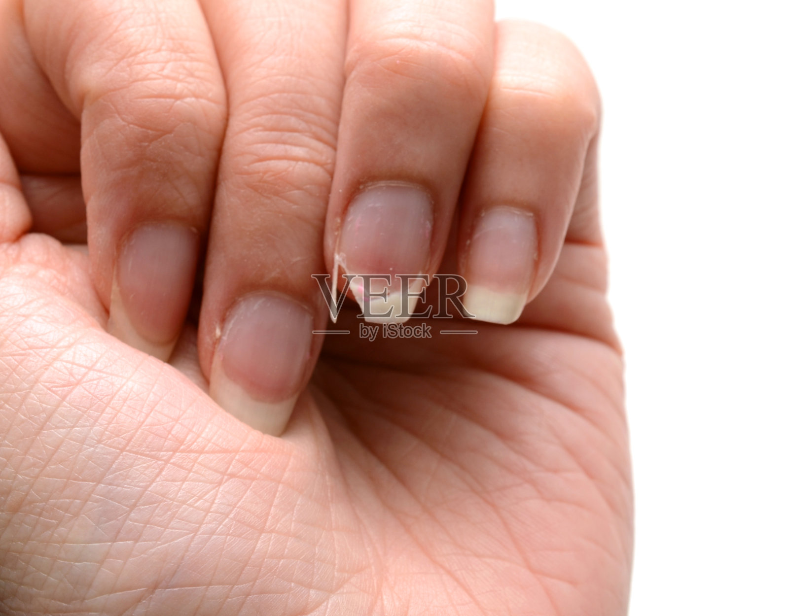 指甲骨折-女性手照片摄影图片