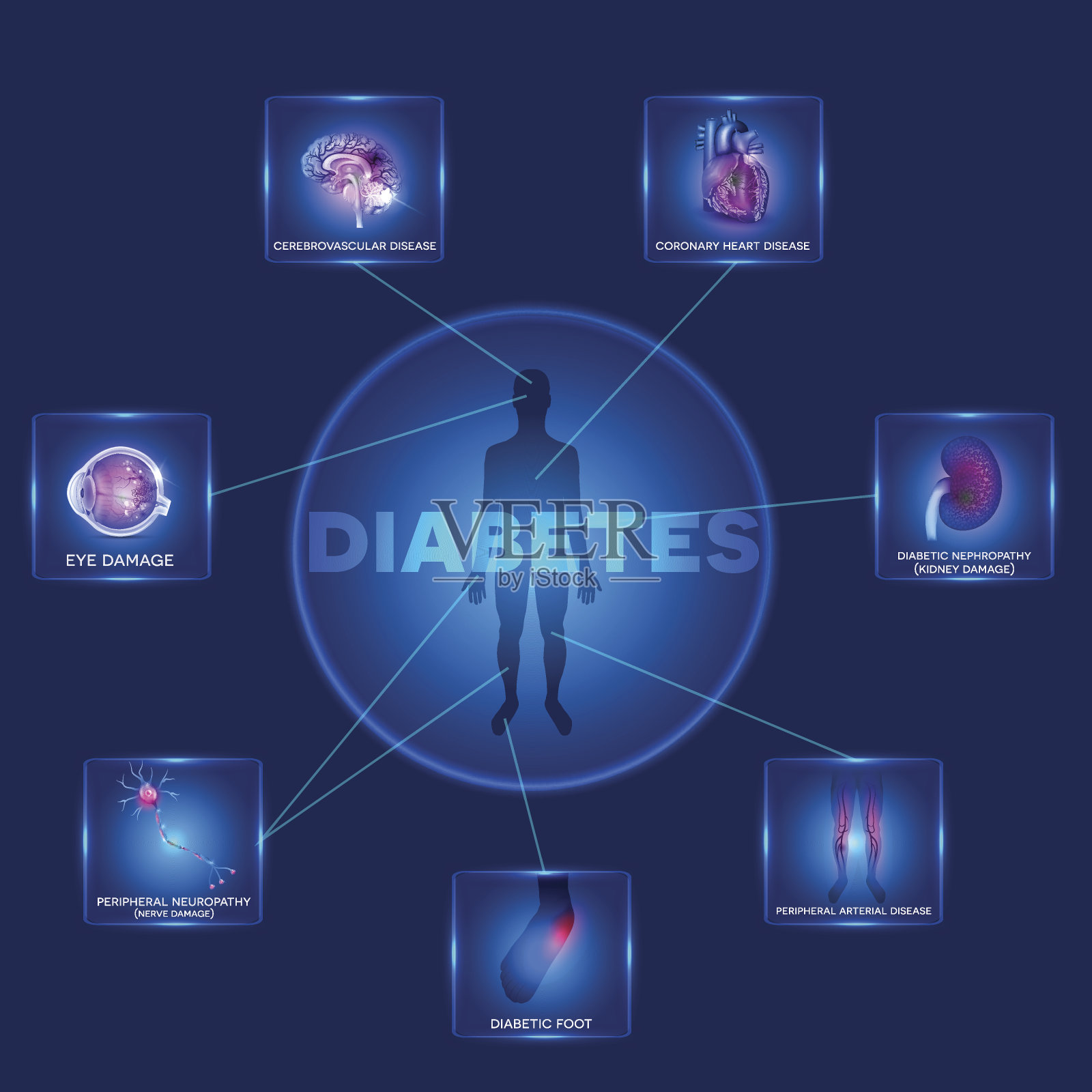 糖尿病影响的器官插画图片素材