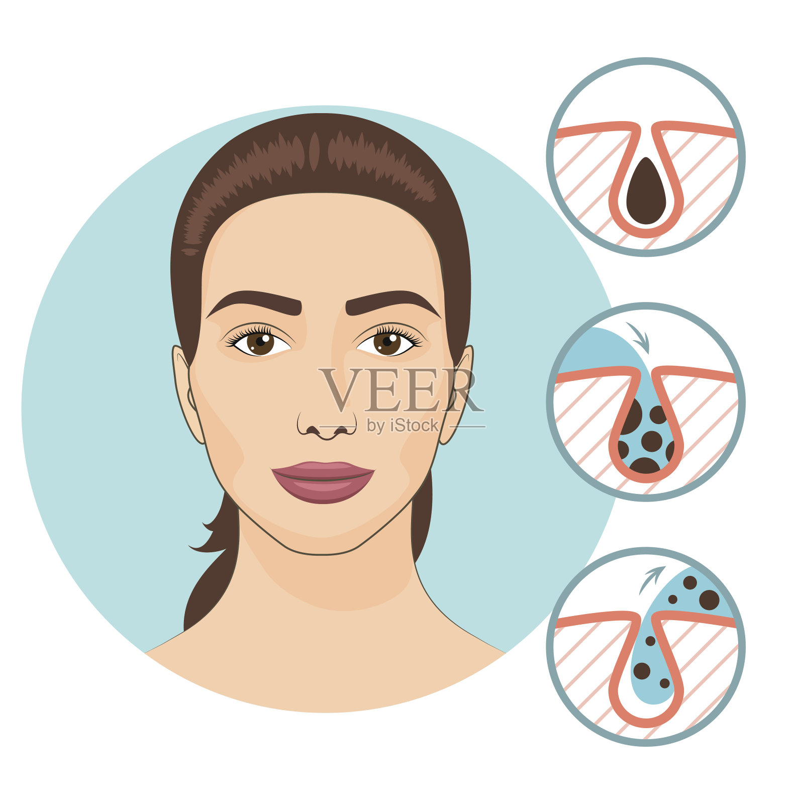女人面部治疗。皮肤问题和面部护理矢量插图插画图片素材