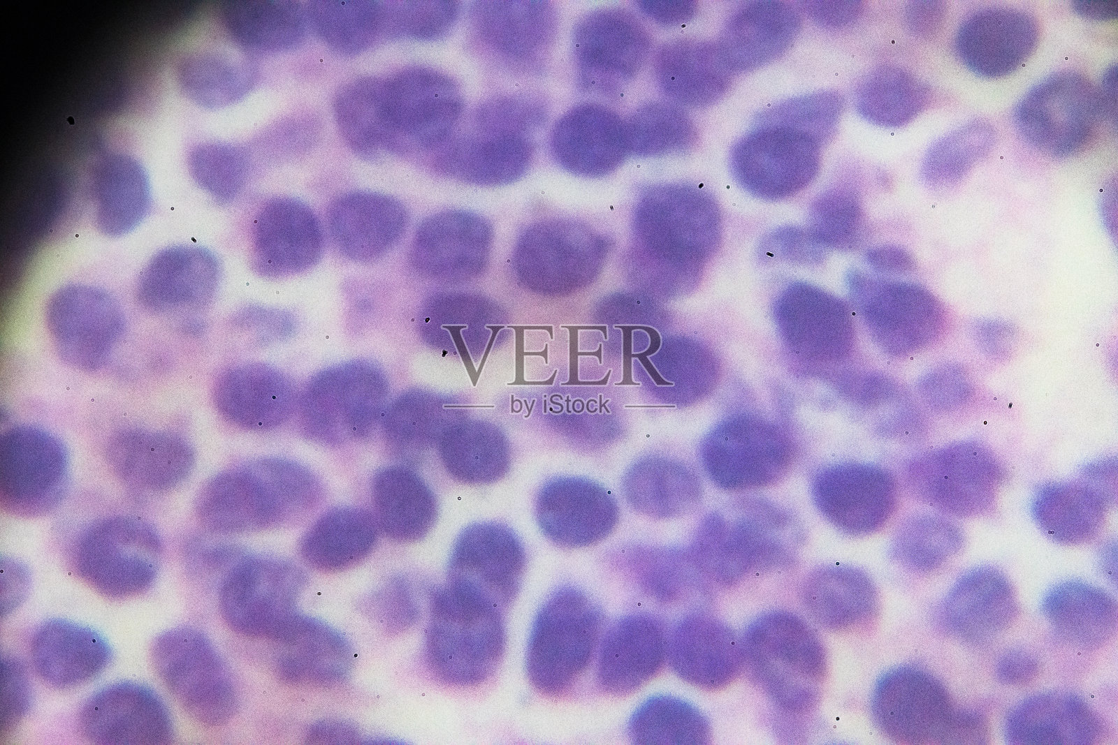 显微镜下嗜酸性粒细胞血细胞照片摄影图片