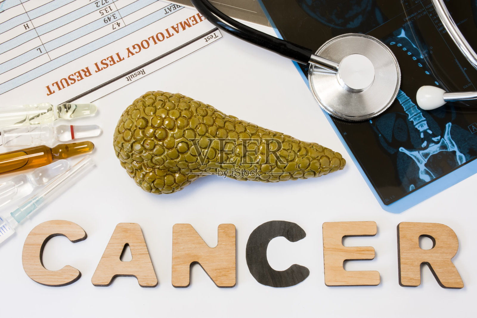 胰腺癌的概念。胰腺的解剖形态位于字母组成词癌附近，周围环绕着一系列的测试、分析、药物、核磁共振和听诊器。胰腺癌的诊断治疗照片摄影图片